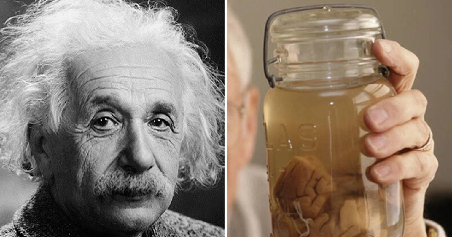 Bac si “dien ro” nao ca gan danh cap bo nao cua thien tai Einstein?-Hinh-7