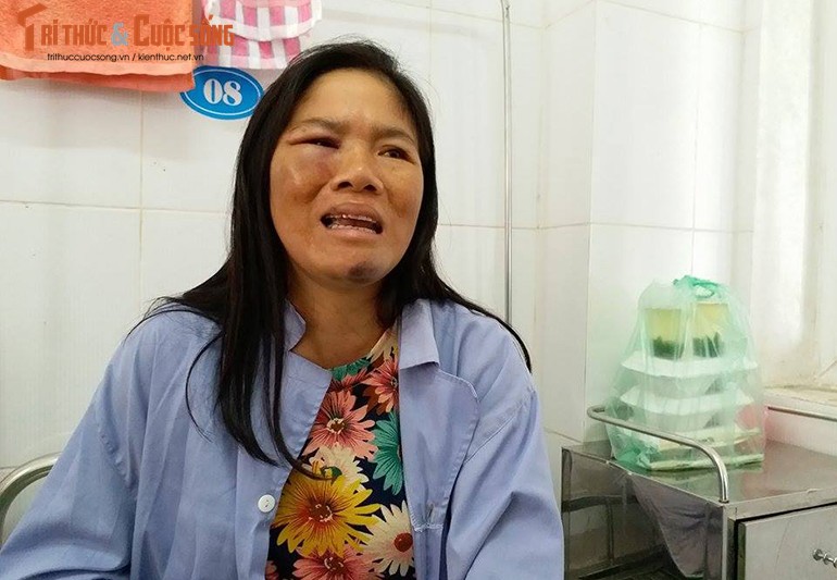 Anh: Canh khon kho cua nguoi bi danh oan vi nghi bat coc tre em o HN-Hinh-17